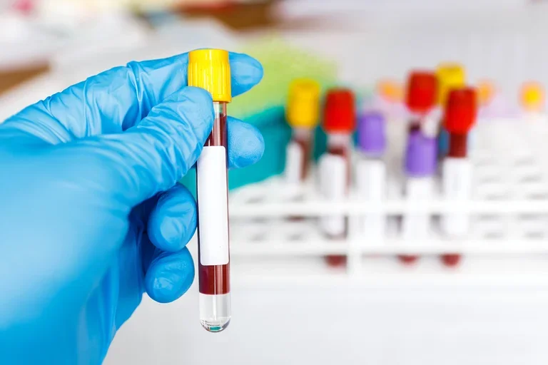 blood biomarkers collected in tubes