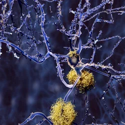 image-neurons-amyloid-plaques