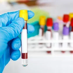 blood biomarkers collected in tubes
