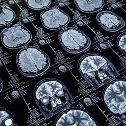 brain scans